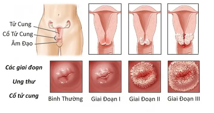 Ứng Cúng Là Gì? Ý Nghĩa, Từ Nguyên Và Vị Trí Trong 10 Danh Hiệu Của Đức Phật