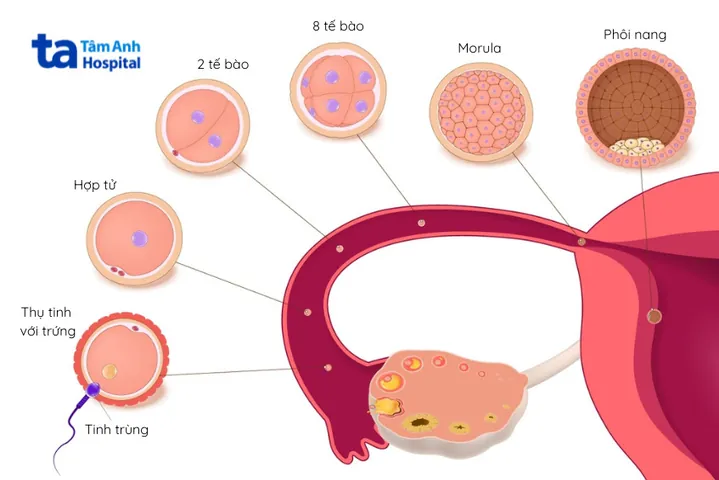 100+ Vung Sau Gáy Có Ảnh Hưởng Đến Mang Thai Hay Nhất 100+ Vung Sau Gáy Có Ảnh Hưởng Đến Mang Thai Hay Nhất