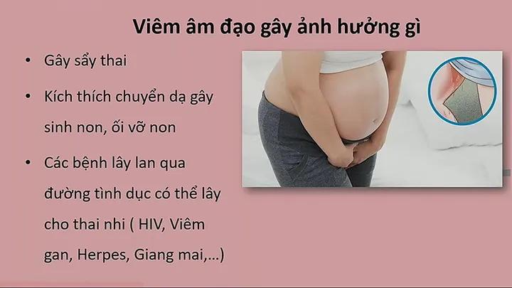 100+ Vung Sau Gáy Có Ảnh Hưởng Đến Mang Thai Hay Nhất 100+ Vung Sau Gáy Có Ảnh Hưởng Đến Mang Thai Hay Nhất