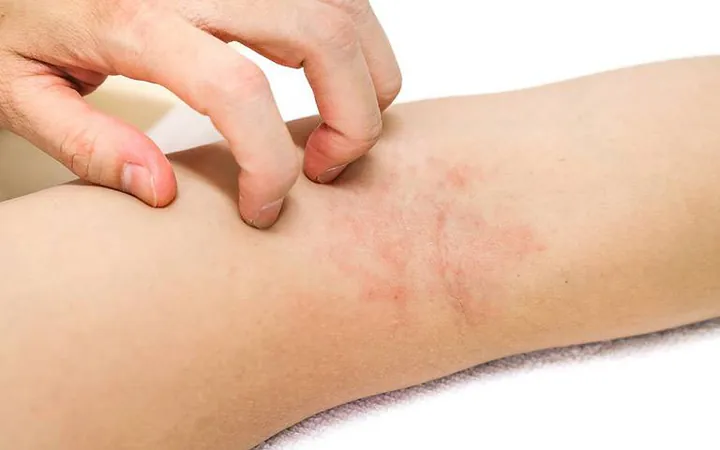 100+ Vung Sau Gáy Có Ảnh Hưởng Đến Mang Thai Hay Nhất 100+ Vung Sau Gáy Có Ảnh Hưởng Đến Mang Thai Hay Nhất