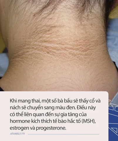 100+ Vung Sau Gáy Có Ảnh Hưởng Đến Mang Thai Hay Nhất 100+ Vung Sau Gáy Có Ảnh Hưởng Đến Mang Thai Hay Nhất