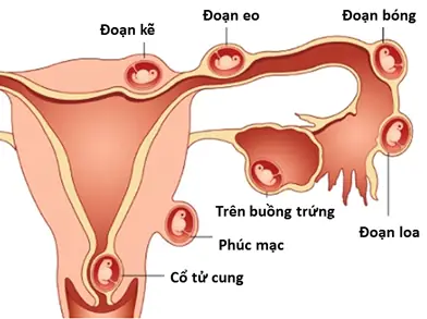 Cần Phải Cúng Gì Khi Bị Sẩy Thai Để Thai Nhi Siêu Thoát & An Lành Cần Phải Cúng Gì Khi Bị Sẩy Thai Để Thai Nhi Siêu Thoát & An Lành
