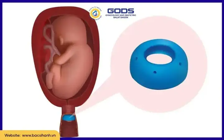 Cần Phải Cúng Gì Khi Bị Sẩy Thai Để Thai Nhi Siêu Thoát & An Lành Cần Phải Cúng Gì Khi Bị Sẩy Thai Để Thai Nhi Siêu Thoát & An Lành