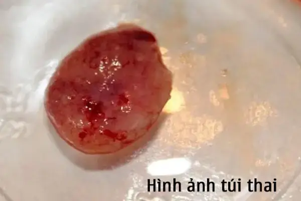 Cần Phải Cúng Gì Khi Bị Sẩy Thai Để Thai Nhi Siêu Thoát & An Lành Cần Phải Cúng Gì Khi Bị Sẩy Thai Để Thai Nhi Siêu Thoát & An Lành