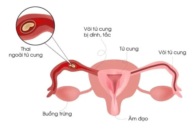 Bài Cúng Cô Bác Ngoài Sân: Hướng Dẫn Chi Tiết Và Văn Khấn Chuẩn Bài Cúng Cô Bác Ngoài Sân: Hướng Dẫn Chi Tiết Và Văn Khấn Chuẩn