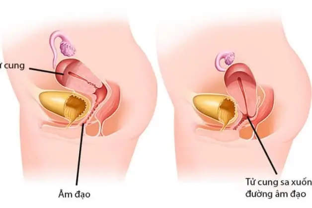 Cúng Sả Có Sao Không? Nghi Lễ, Ý Nghĩa Và Những Điều Cần Lưu Ý