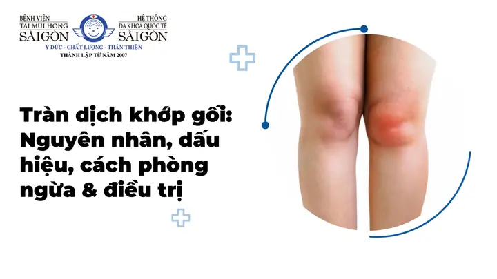 Hút Dịch Mũi Cảm Cúm Ở Đâu Tphcm Uy Tín, An Toàn? Hút Dịch Mũi Cảm Cúm Ở Đâu Tphcm Uy Tín, An Toàn?