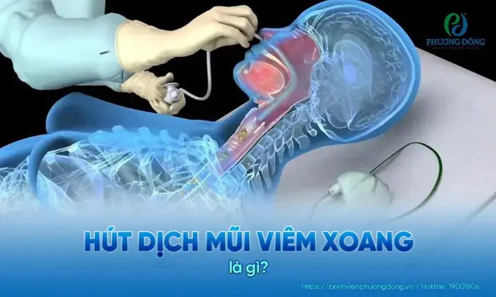 Hút Dịch Mũi Cảm Cúm Ở Đâu Tphcm Uy Tín, An Toàn? Hút Dịch Mũi Cảm Cúm Ở Đâu Tphcm Uy Tín, An Toàn?